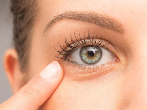 How To Remove Dark Spots On Eyes 1 How To Remove Dark Spots On Eyes | Beautification Tips and Tricks